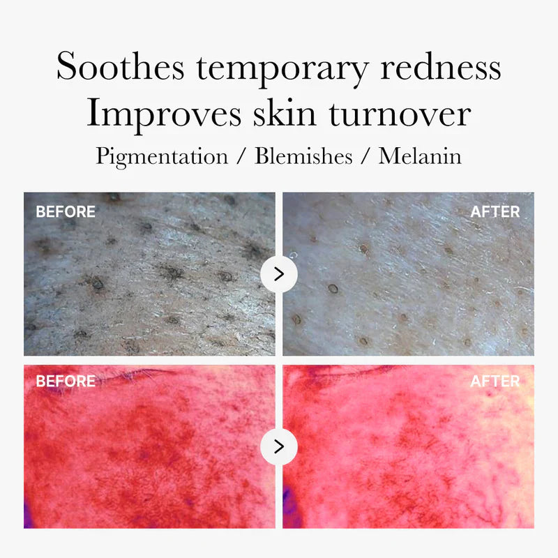 Mix & Match Toner Pad Pore, Use After Spot, Brightening Care for Clear & Glass Glow SkinToner Pads