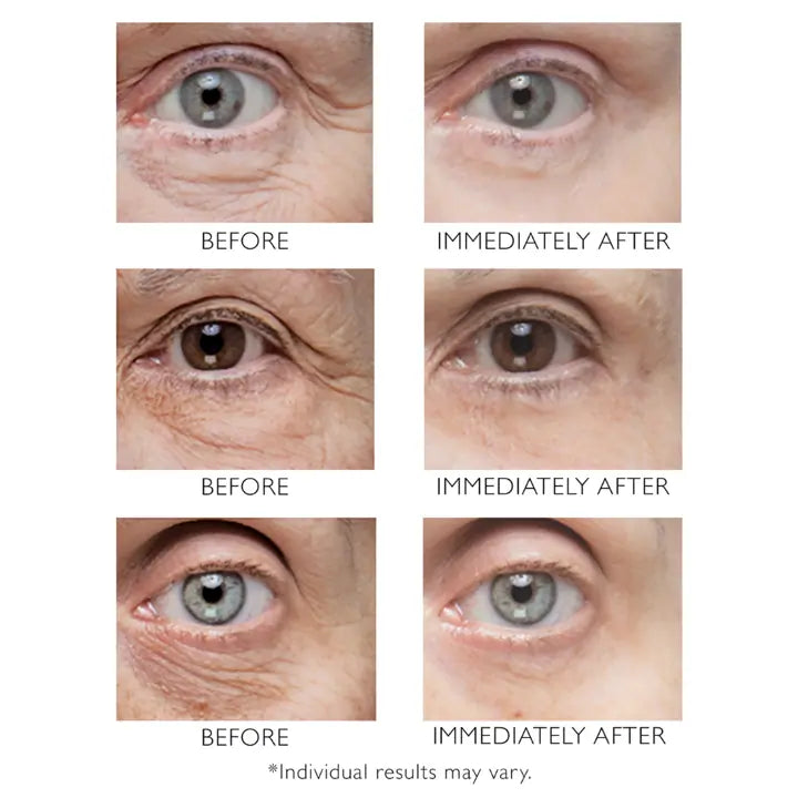 Peter Thomas Roth Instant FirmX Eye 30ml.2