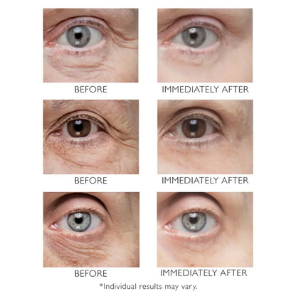 Peter Thomas Roth Instant FirmX Eye 30ml.2